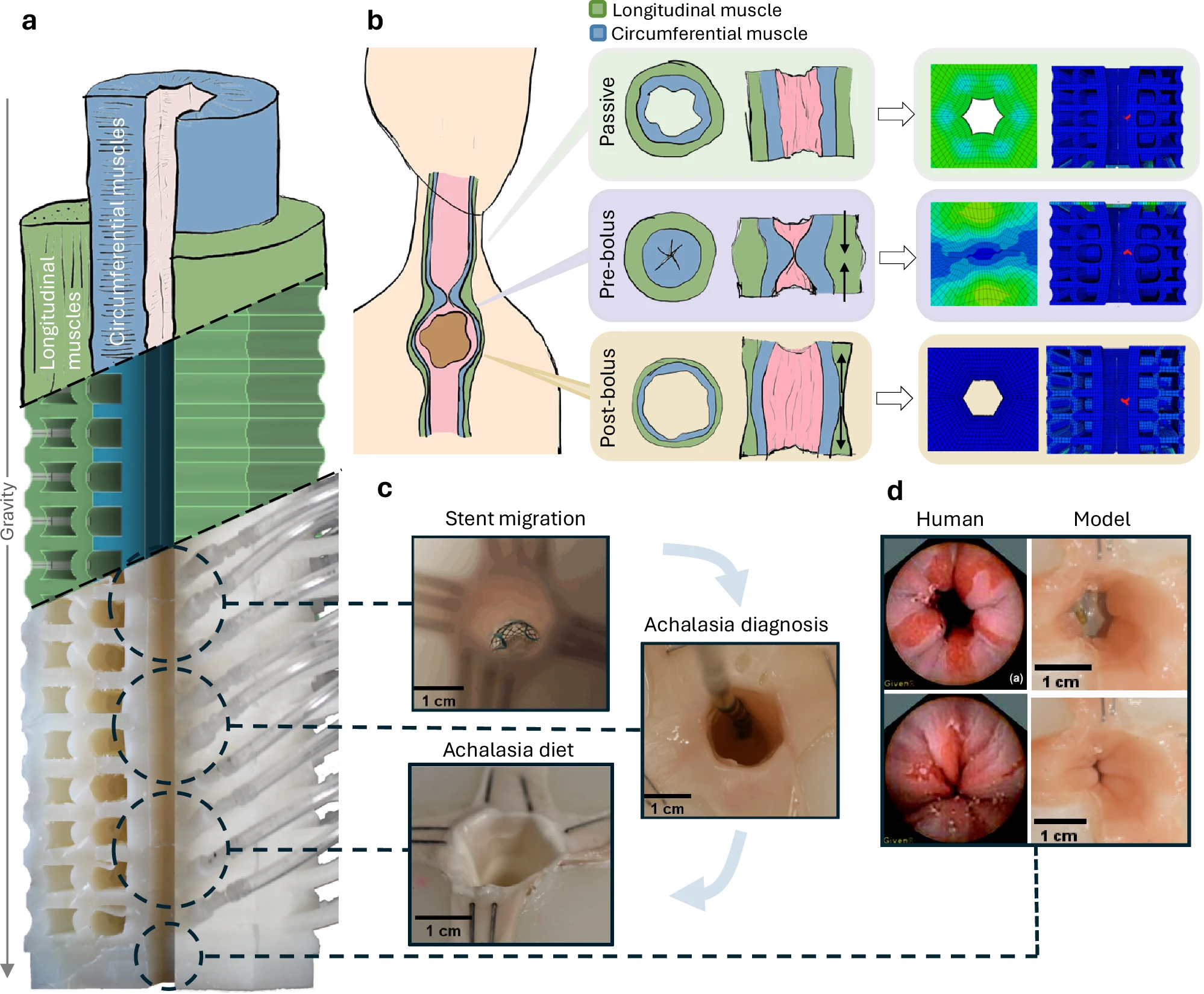 Kilroy et al., Nature Communications (2026) — biomimetic esophageal motility simulation