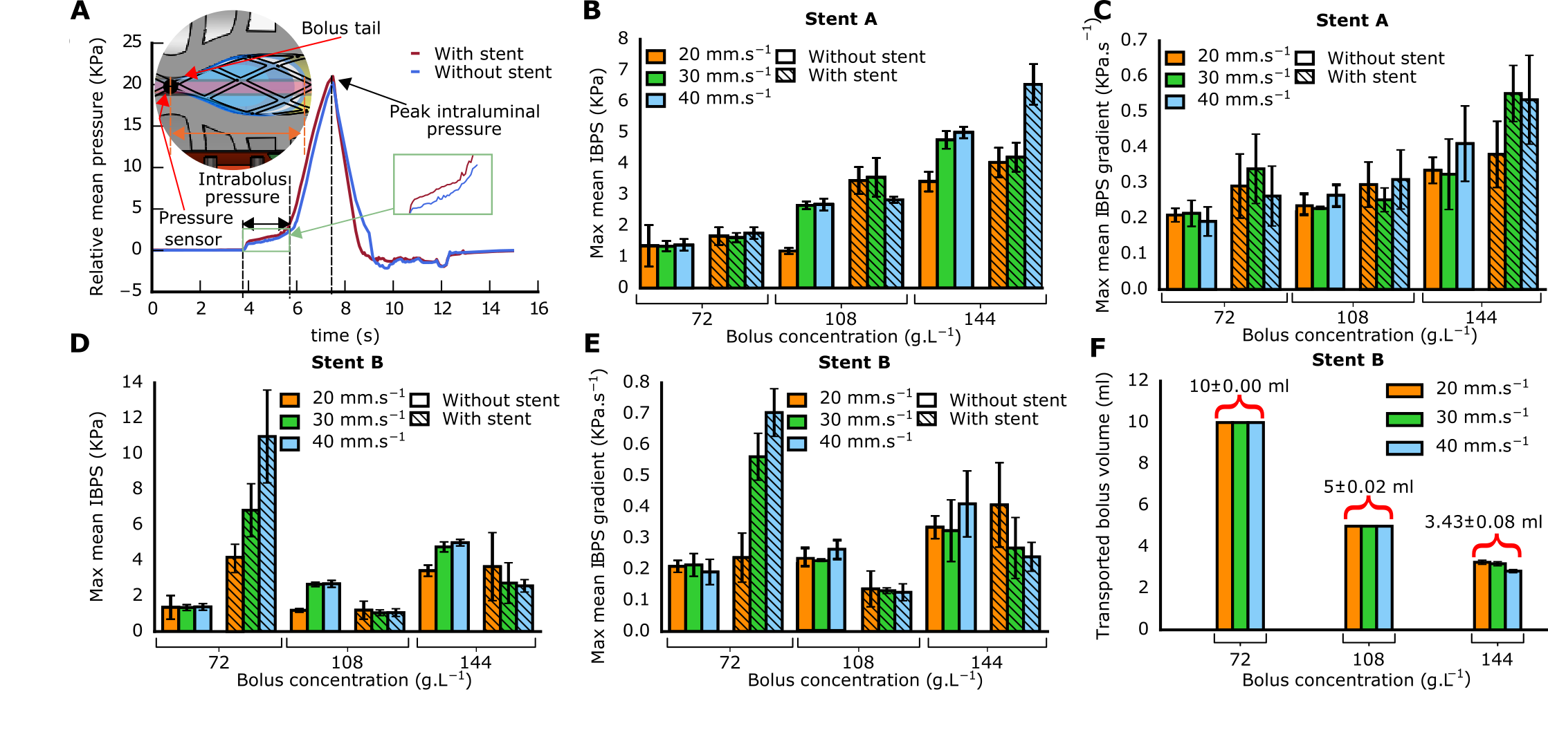 Manometry IBPS results with and without stents