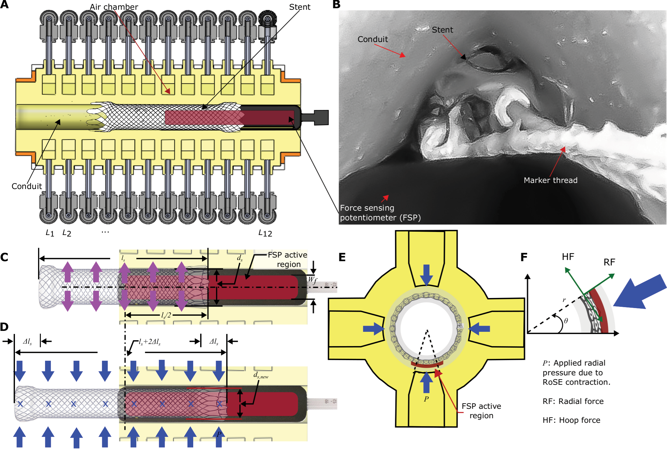 Experimental setup for stent radial force measurement in RoSE